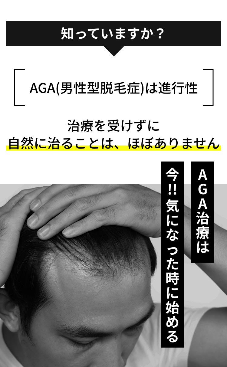 AGA(男性型脱毛症)は進行性です